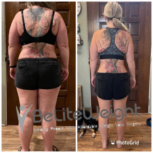 Carolyn R - 6 Month Update*